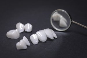 porcelain veneers